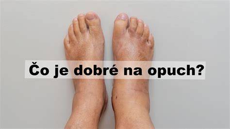 Tabuľka: bežné zdravotné príčiny nadmerného lízania nôh