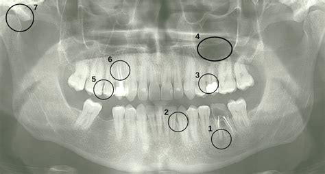 RTG snímok chrbtice psa s vyznačenými osteofytmi