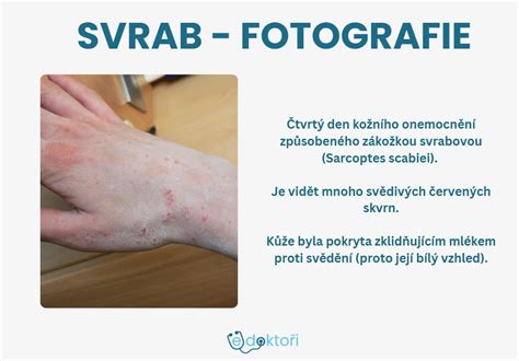 Príklad fotografie s chybnými prstami vytvorenej AI