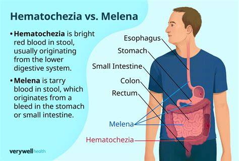 Infografika: Hematochézia vs. Melena - kde krv pochádza