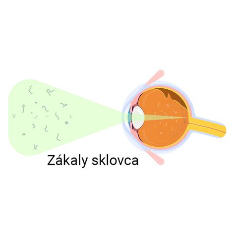 Mapa predisponovaných plemien na očné ochorenia