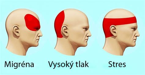 Rozdelenie hlavy psa na mozgovňu a čenichovú partiu