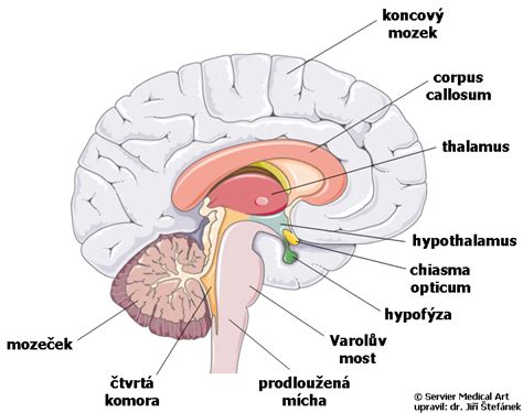 Schéma endovaskulárnej liečby aneuryzmy mozgu pomocou platinových cievok