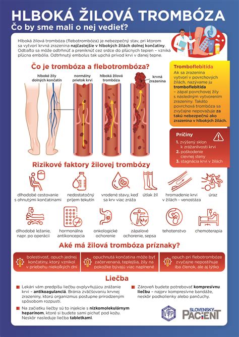 Infografika znázorňujúca príčiny a prejavy akútnej končatinovej ischémie