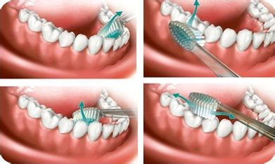 Čistenie zubov psovi