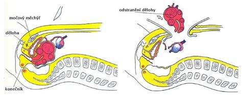 Schematický nákres sťahovania kože zvieraťa