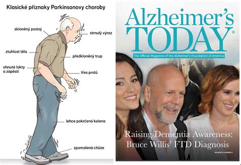 Ilustrácia psa s príznakmi vedľajších účinkov