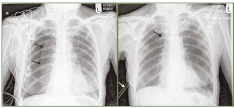 RTG snímka hrudníka psa