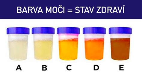 Rôzne druhy psích výkalov a ich význam