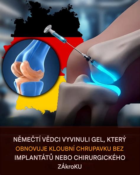 Schéma chirurgického zákroku na pupočnú prietrž