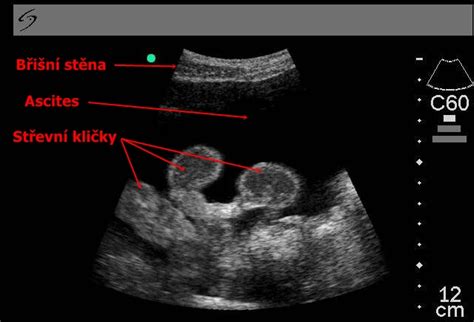 Ultrazvuk brušnej dutiny mačky s ascitesom