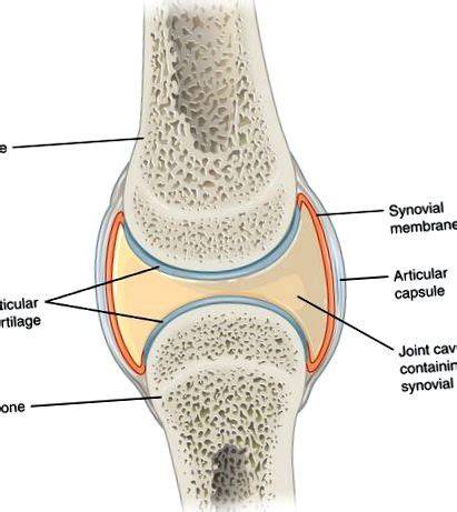 Infografika: anatomia kĺbu a mechanizmus poškodenej chrupavky