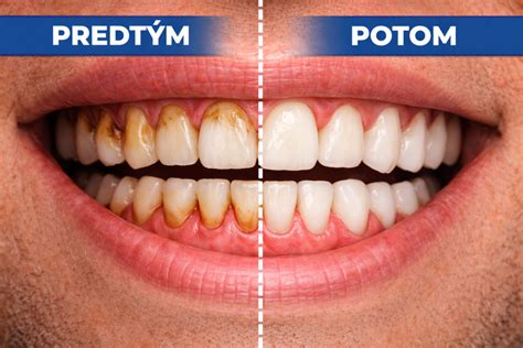 Infografika: Ako funguje dentálna hygiena u psov a čo zahŕňa