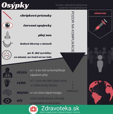 Infografika: Ako sa šíria osýpky a štádiá ochorenia