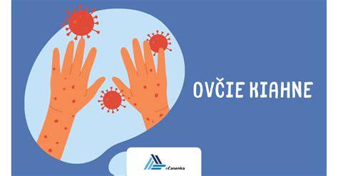 Tabuľka porovnania: Osýpky vs. Ovčie kiahne