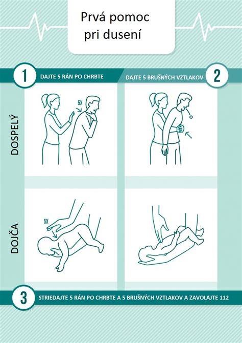 Infografika: Správne kroky prvej pomoci pri dusení psa