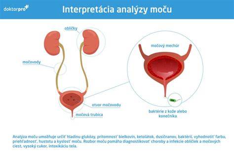 Infografika: Cesta moču od obličiek po močový mechúr