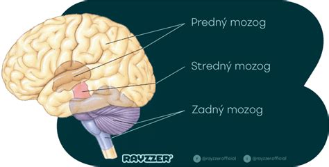 Štruktúra psieho mozgu a porovnanie s ľudským