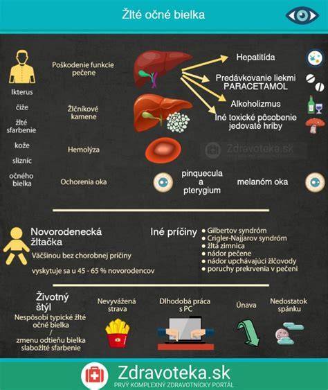 Infografika: Prehľad príčin a liečby žalúdočných ťažkostí