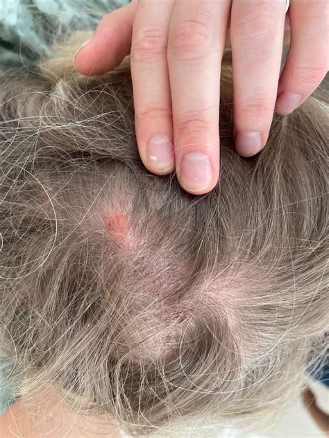 Ilustrácia psa s vyrážkou na hlave