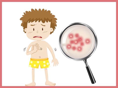 Ilustrácia bakteriálnej infekcie kože