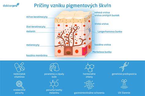 Mapa rizík pigmentácie na tvári a tele
