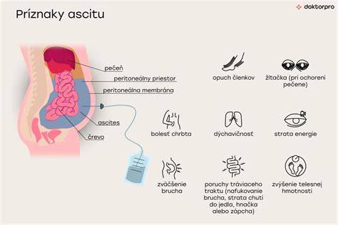 Infografika: Ascites u psov - čo to je a ako to vyzerá