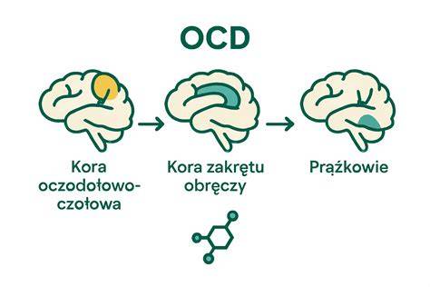 Infografika: OCD - mechanismus vzniku a liečby
