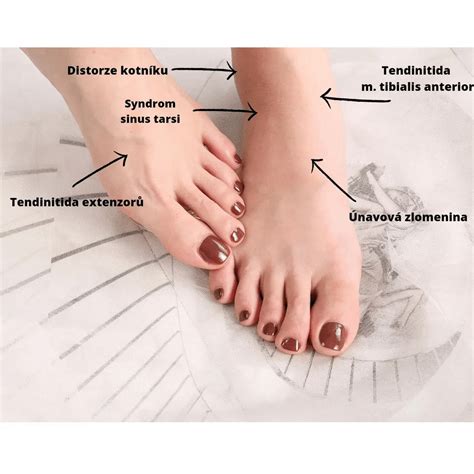 Ilustrácia anatómie nechtu na nohe