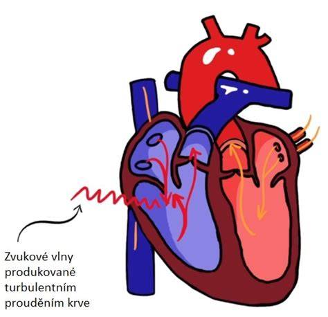 Infografika: ako funguje srdce psa a čo spôsobuje šelest