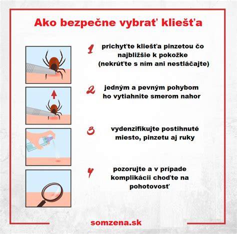 Infografika: Ako bezpečne vybrať kliešťa a kroky po prechádzke