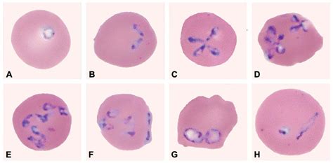 Ilustrácia parazita Babesia v červených krvinkách