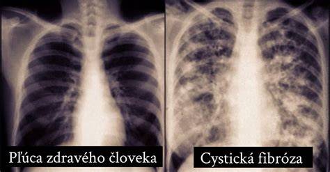 Mapa rizík: Kľúčové genetické ochorenia bulteriéra a ich prevencia