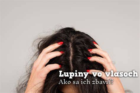 Infografika: Vývoj plemena a hlavné rozdiely vo vlasoch a tvaroch