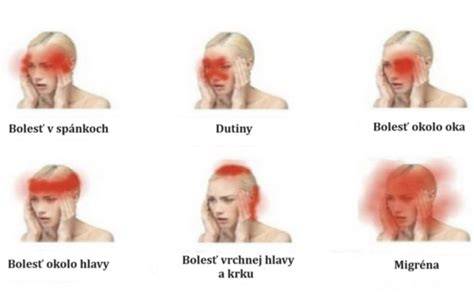 Diagramy: kalmujúce signály psa (zívnutie, odvrátenie hlavy, oblúkovitý prístup, lol) a ich význam