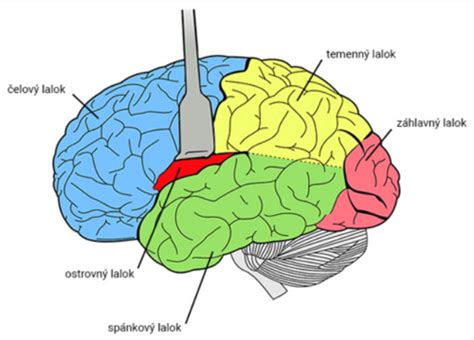Ilustrácia mozgu psa pri spracovaní reči