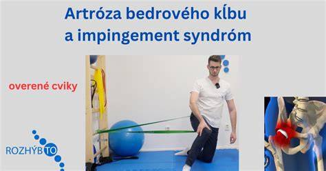 Infografika: Hemisférické rozloženie dysplázie bedrového kĺbu a rizikových plemien