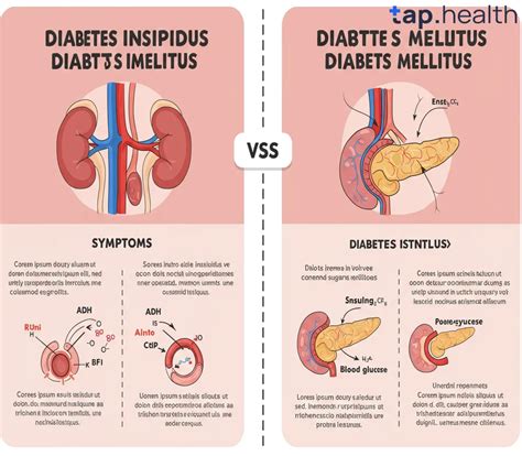 Porovnanie Diabetes Mellitus a Diabetes Insipidus