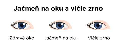 Infografika: Ako rozoznať jačmeň na oku a vlčie zrno