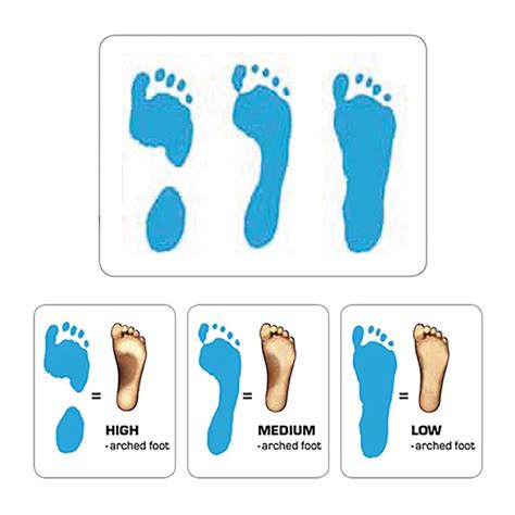 Odtlačok chodidla s vysokou klenbou