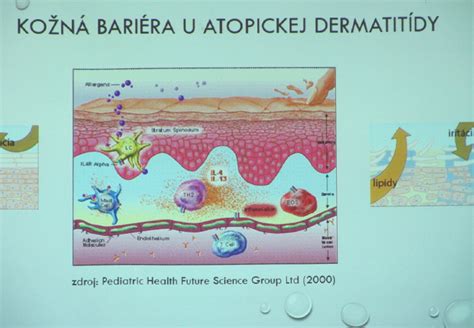 Ilustrácia psa so symptómami atopickej dermatitídy