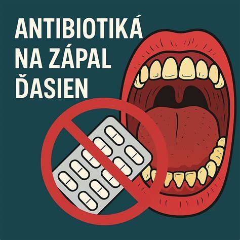 Infografika: etapas zápalu ďasien a parodontálne ochorenie
