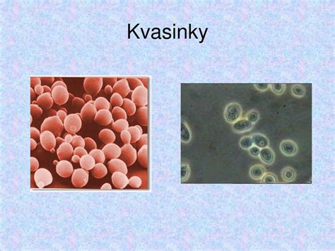 Mikroskopická fotografia kvasinky Malassezia