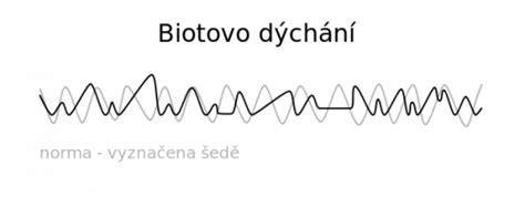 Infografika: znaky blížiaceho sa konca života psa