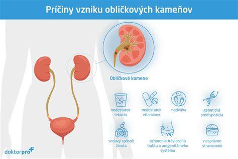 Infografika: Cesty lupín od vzniku po liečbu - príčiny, symptómy, diagnostika, liečba